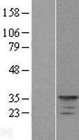 KCNIP4 Human Over-expression Lysate