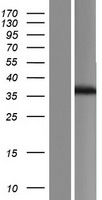 FBXO17 Human Over-expression Lysate