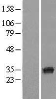 SDR O (SDR9C7) Human Over-expression Lysate