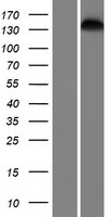 SMC1L2 (SMC1B) Human Over-expression Lysate