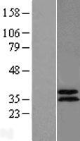 ABHD11 Human Over-expression Lysate