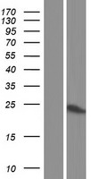 PSMB9 Human Over-expression Lysate