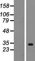 HUS1B Human Over-expression Lysate