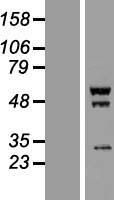 SCYL1BP1 (GORAB) Human Over-expression Lysate