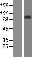 ZNF585B Human Over-expression Lysate