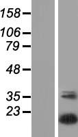 UBTD2 Human Over-expression Lysate