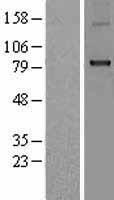 CPT1B Human Over-expression Lysate