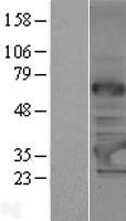 C14orf172 (TRMT61A) Human Over-expression Lysate