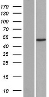 ADA2 beta (TADA2B) Human Over-expression Lysate