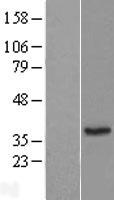 ERP27 Human Over-expression Lysate