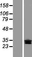 CLRN3 Human Over-expression Lysate