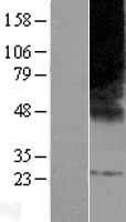 Elongation of very long chain fatty acids protein 3 (ELOVL3) Human Over-expression Lysate