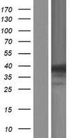 ANKRD9 Human Over-expression Lysate