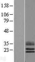TEX29 Human Over-expression Lysate