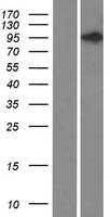 DIS3L2 Human Over-expression Lysate