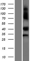 C1orf172 (KDF1) Human Over-expression Lysate
