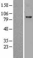 CPT1C Human Over-expression Lysate