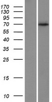 AIF (AIFM1) Human Over-expression Lysate