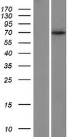 AIF (AIFM1) Human Over-expression Lysate