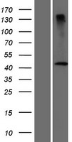 DCAF4L2 Human Over-expression Lysate