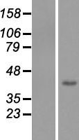 FBXL14 Human Over-expression Lysate
