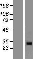 CCDC24 Human Over-expression Lysate