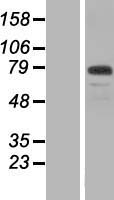 WDR65 (CFAP57) Human Over-expression Lysate