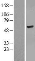 ZNF385B Human Over-expression Lysate