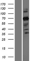 PARIS (ZNF746) Human Over-expression Lysate