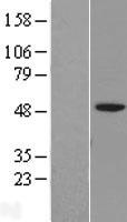 IGSF11 Human Over-expression Lysate
