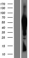 TTC39B Human Over-expression Lysate