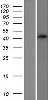 Sphingomyelin Synthase 2 (SGMS2) Human Over-expression Lysate