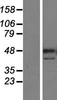 PARP15 Human Over-expression Lysate