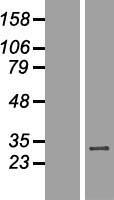WBP2NL Human Over-expression Lysate