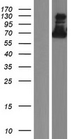 ZNF579 Human Over-expression Lysate