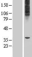 MFSD6L Human Over-expression Lysate