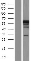 PIP5K3 (PIKFYVE) Human Over-expression Lysate