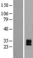DAND5 Human Over-expression Lysate