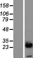 UBE2E2 Human Over-expression Lysate