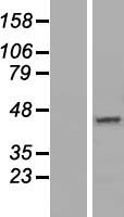 DNAJC18 Human Over-expression Lysate