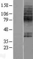 SLC23A1 Human Over-expression Lysate