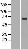 FAM116A (DENND6A) Human Over-expression Lysate