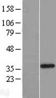 SLC25A16 Human Over-expression Lysate