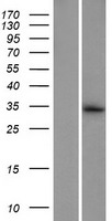 TEX47 Human Over-expression Lysate