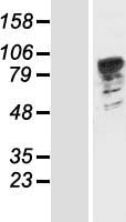 PATL1 Human Over-expression Lysate