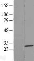CFAP299 Human Over-expression Lysate