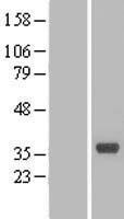 CNPY4 Human Over-expression Lysate