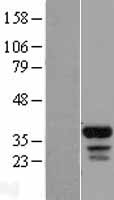 FAM133B Human Over-expression Lysate