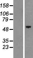 C17orf66 (HEATR9) Human Over-expression Lysate