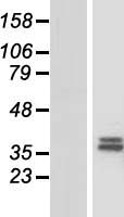 CHST13 Human Over-expression Lysate